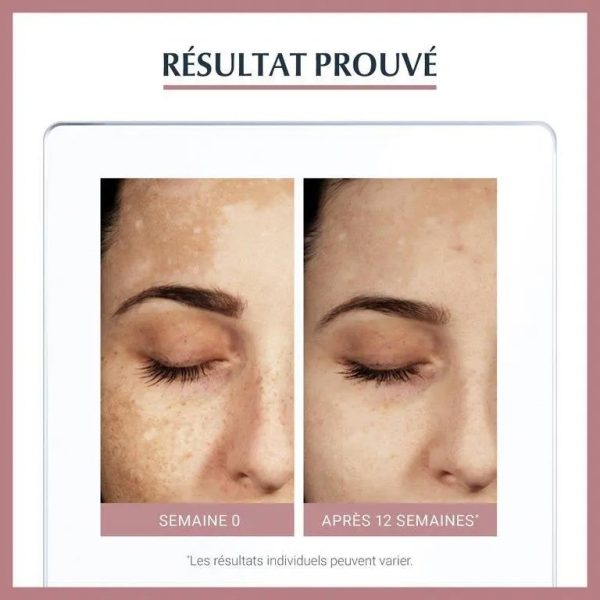 EUCERIN ANTI-PIGMENT SERUM DUO 2x15ml – Image 2