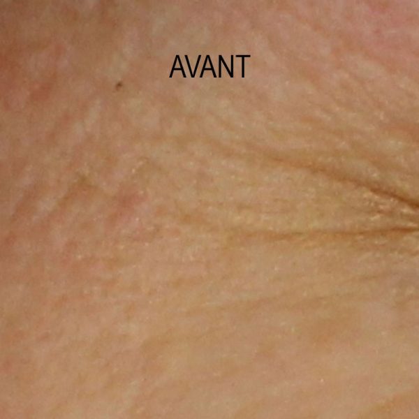 Novexpert – Coffret Peau Repulpée – Image 4