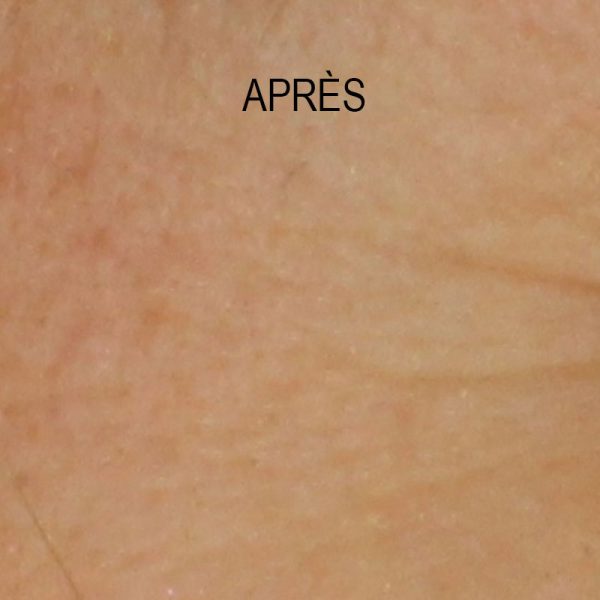 Novexpert – Coffret Peau Repulpée – Image 3