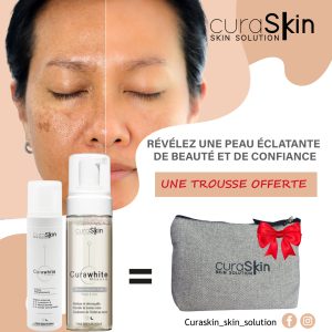 Curaskin Curawhite Mousse Nettoyant Eclat 150ml + Curawhite Intense Creme Depigmentante 50ml = 1 Trousse Offerte
